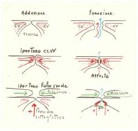 sistemi di forza che causano il nodulo alle corde vocali